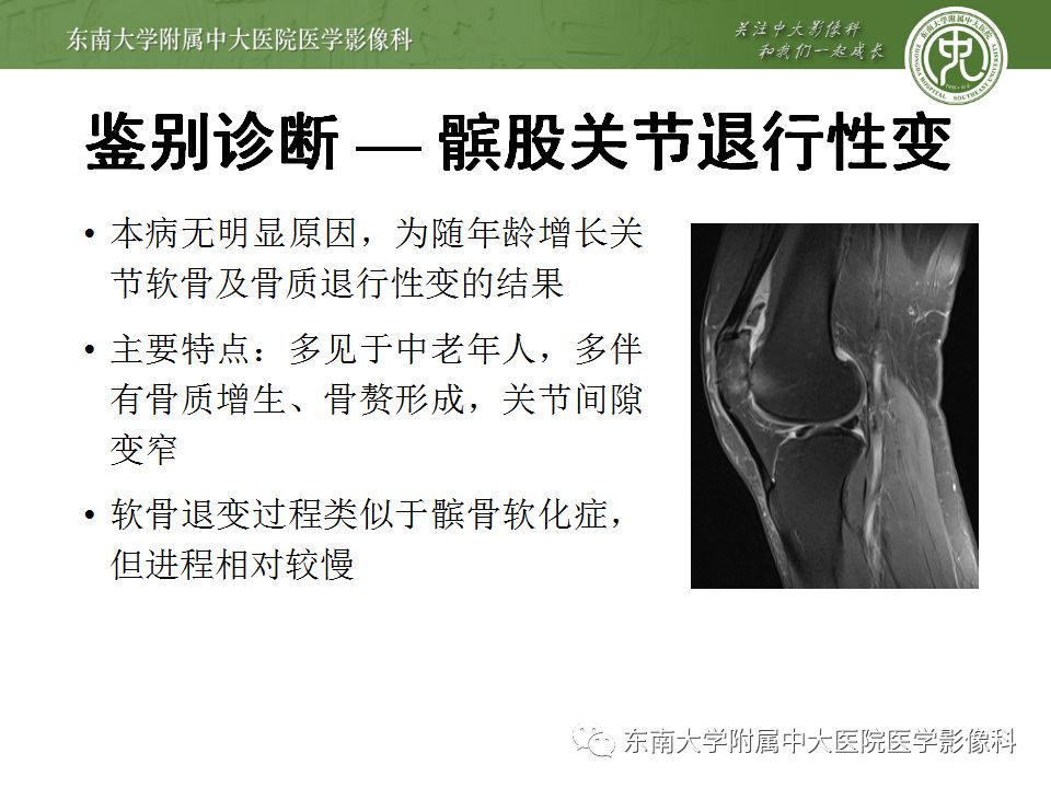 【病例】髌骨软化症1例MR影像诊断