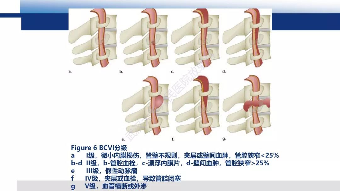 【PPT】头颈部血管钝性损伤影像诊断及治疗