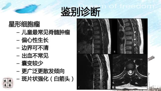 自动草稿 自动草稿
