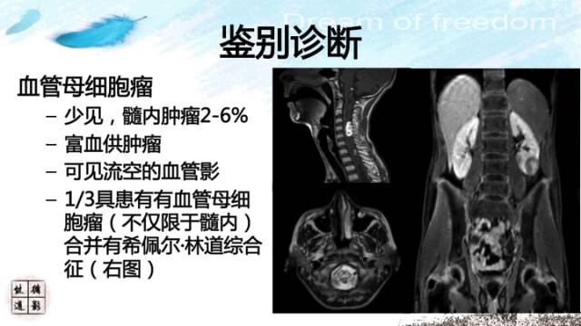 自动草稿 自动草稿