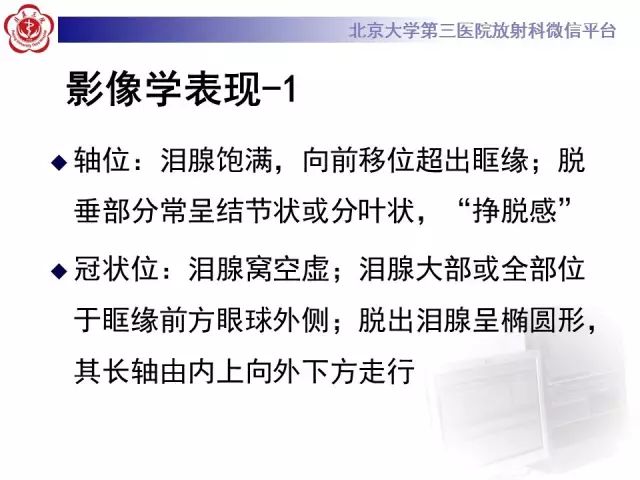 【病例】双侧泪腺脱垂1例CT