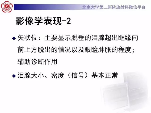 【病例】双侧泪腺脱垂1例CT