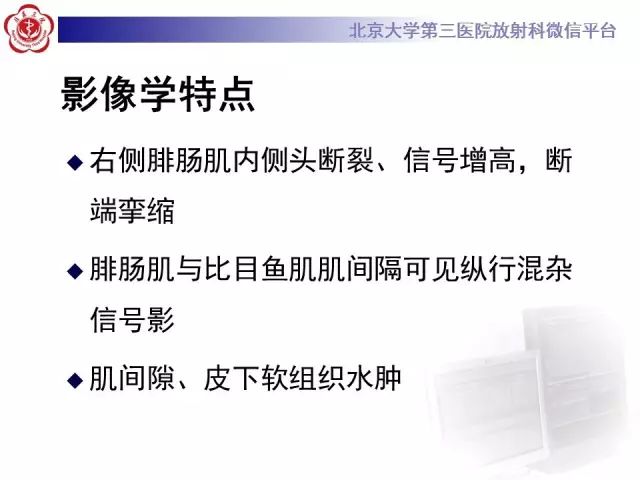 【病例】网球腿1例MR影像诊断