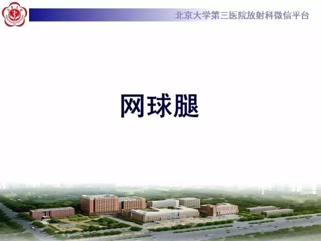 【病例】网球腿1例MR影像诊断