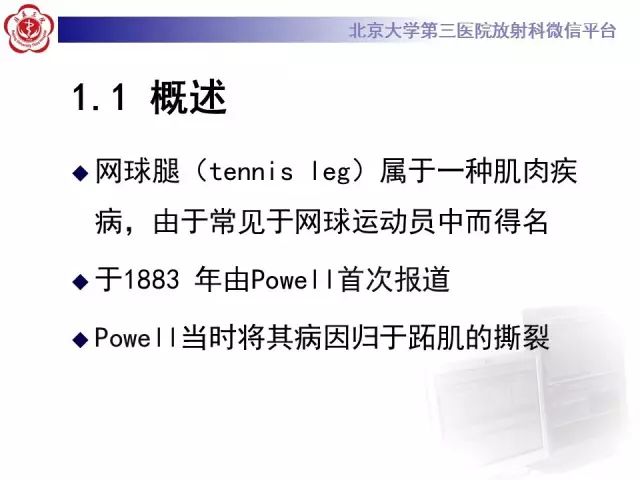 【病例】网球腿1例MR影像诊断