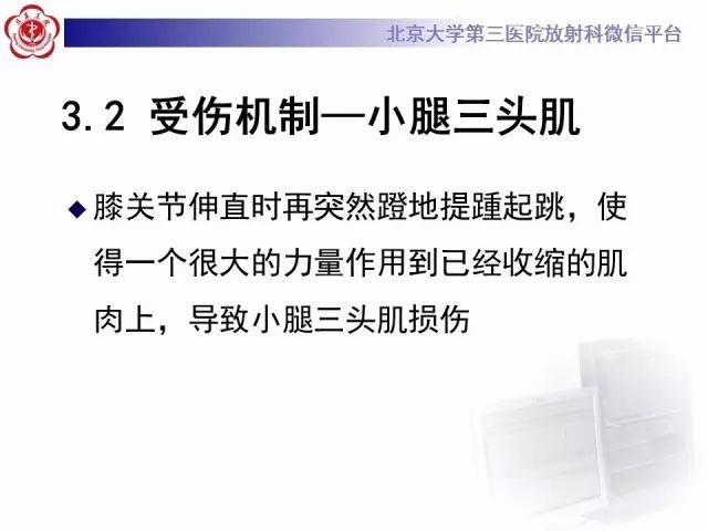 【病例】网球腿1例MR影像诊断