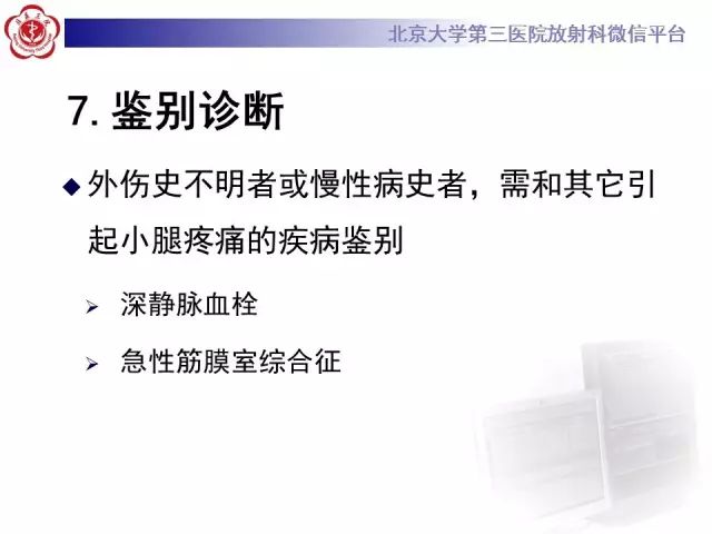 【病例】网球腿1例MR影像诊断