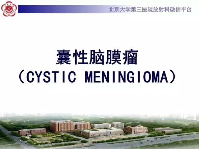 【病例】囊性脑膜瘤1例CT及MR影像诊断