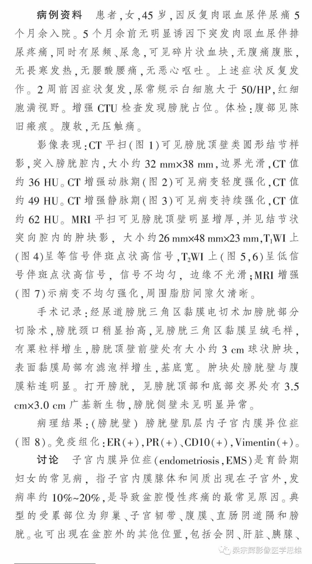 【病例】膀胱壁子宫内膜异位症1例CT及MR影像诊断思维
