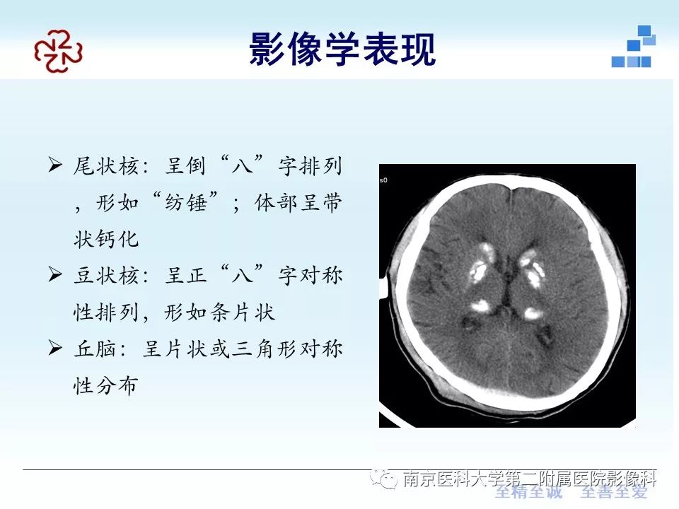 【PPT】Fahr病的影像学表现