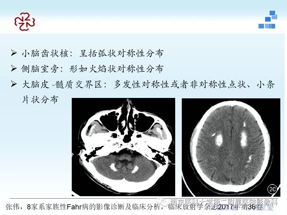 【PPT】Fahr病的影像学表现