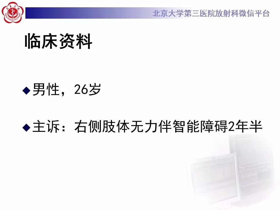【病例】基底节区生殖细胞瘤1例MR影像