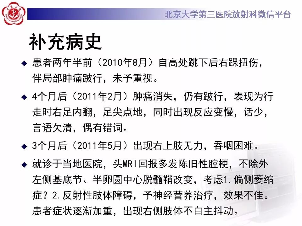 【病例】基底节区生殖细胞瘤1例MR影像