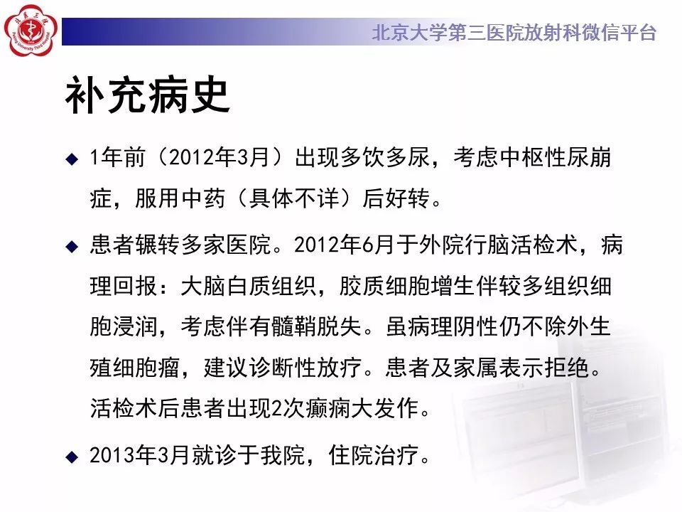 【病例】基底节区生殖细胞瘤1例MR影像