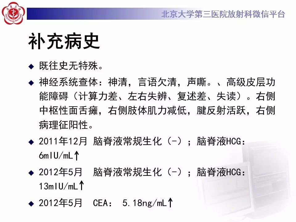 【病例】基底节区生殖细胞瘤1例MR影像