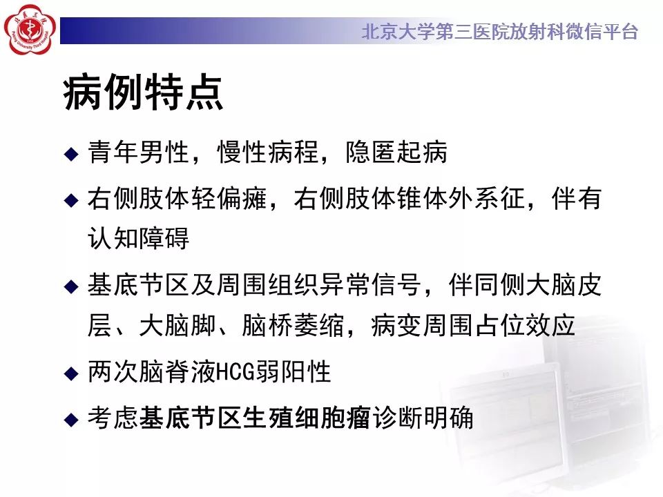 【病例】基底节区生殖细胞瘤1例MR影像