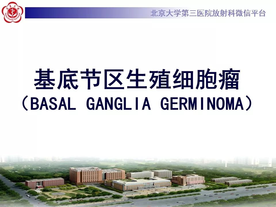 【病例】基底节区生殖细胞瘤1例MR影像