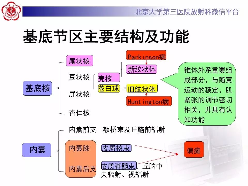 【病例】基底节区生殖细胞瘤1例MR影像