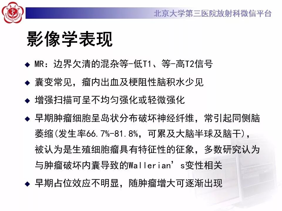 【病例】基底节区生殖细胞瘤1例MR影像