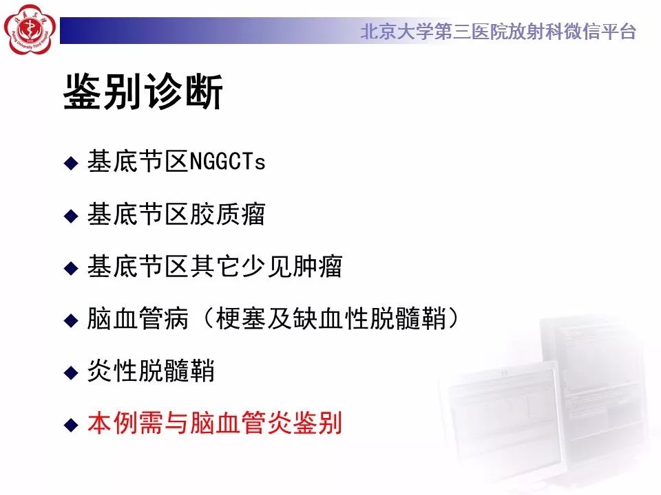 【病例】基底节区生殖细胞瘤1例MR影像