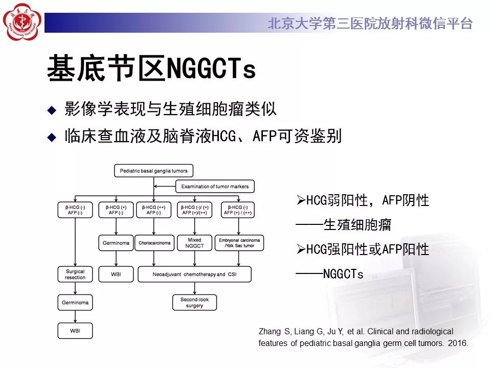 【病例】基底节区生殖细胞瘤1例MR影像
