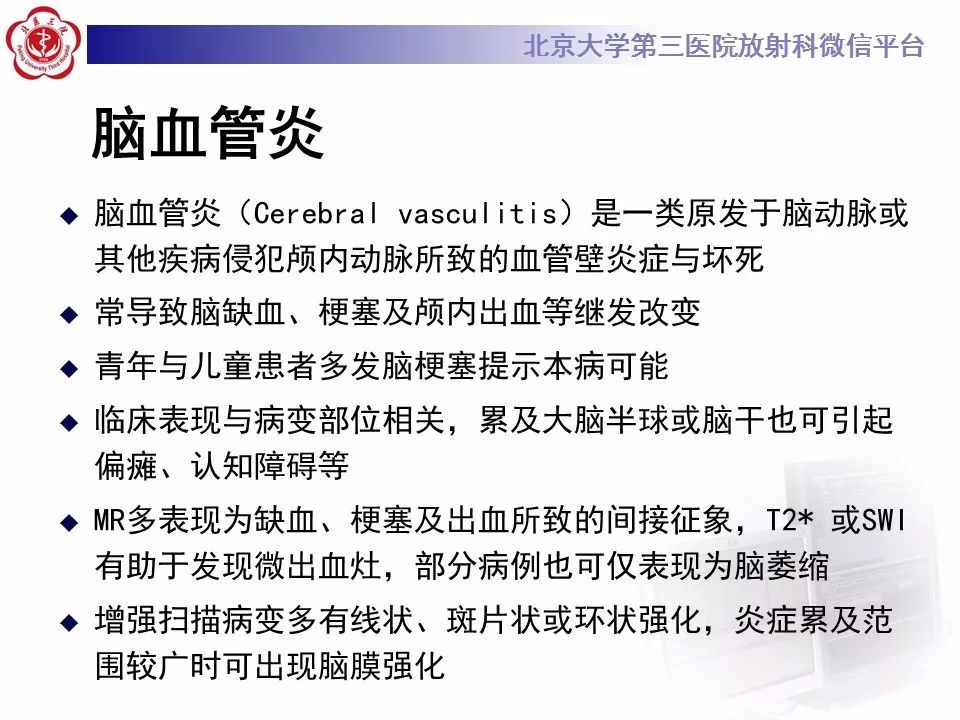 【病例】基底节区生殖细胞瘤1例MR影像
