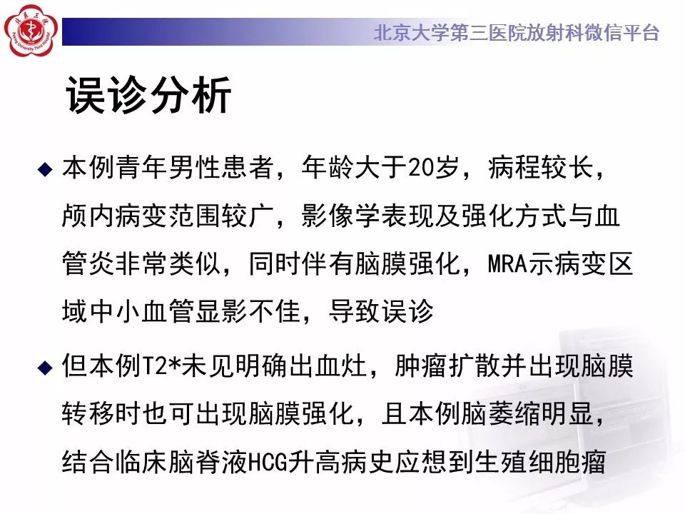 【病例】基底节区生殖细胞瘤1例MR影像