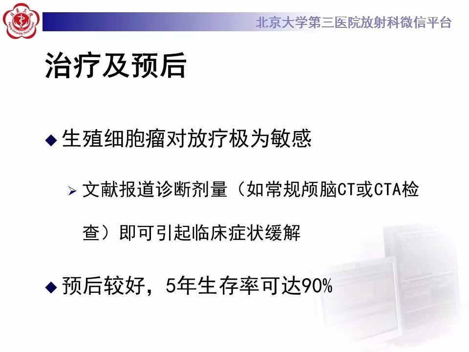 【病例】基底节区生殖细胞瘤1例MR影像
