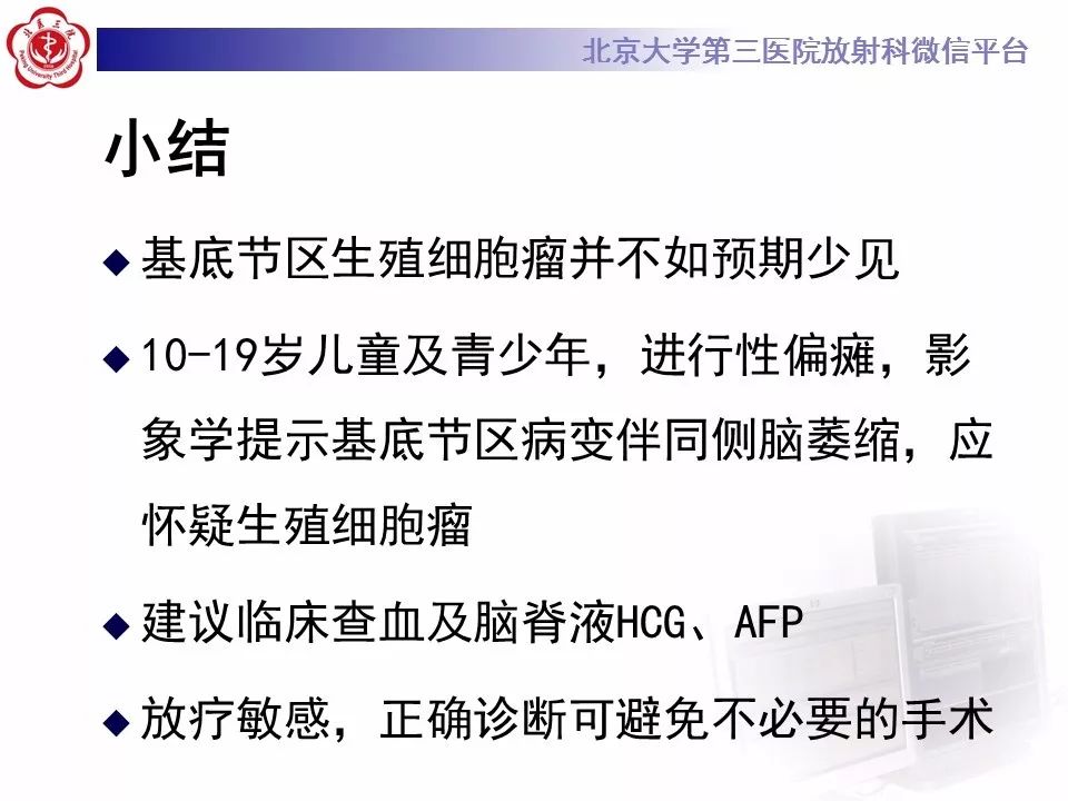 【病例】基底节区生殖细胞瘤1例MR影像