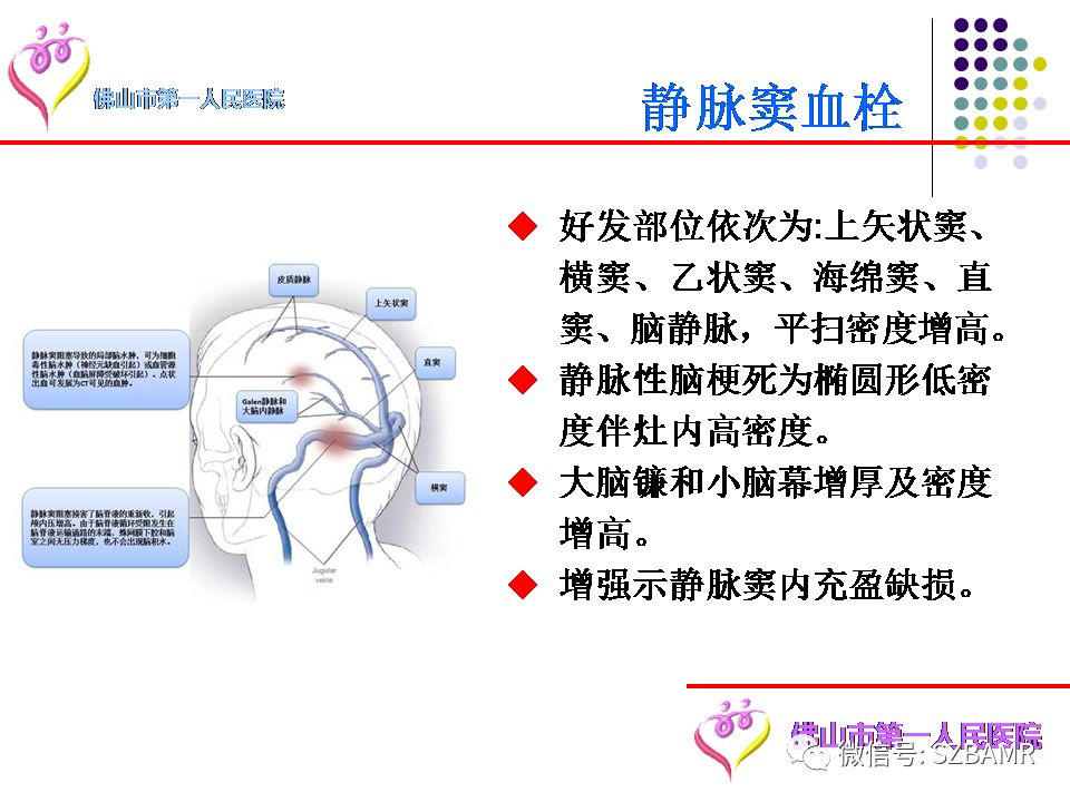 【PPT】脑出血MR表现及病因分析
