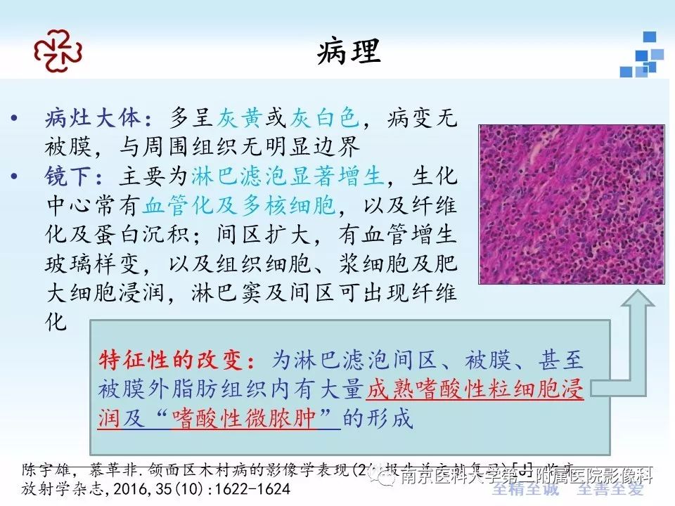 【PPT】专题读片——木村病