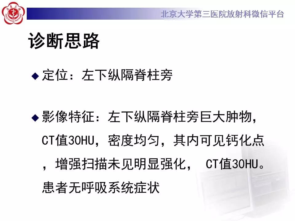 【病例】纵隔节细胞神经瘤1例CT影像表现