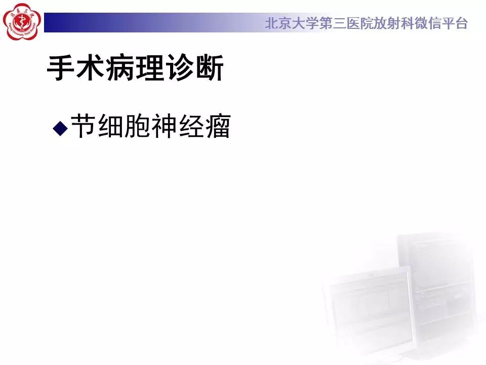 【病例】纵隔节细胞神经瘤1例CT影像表现