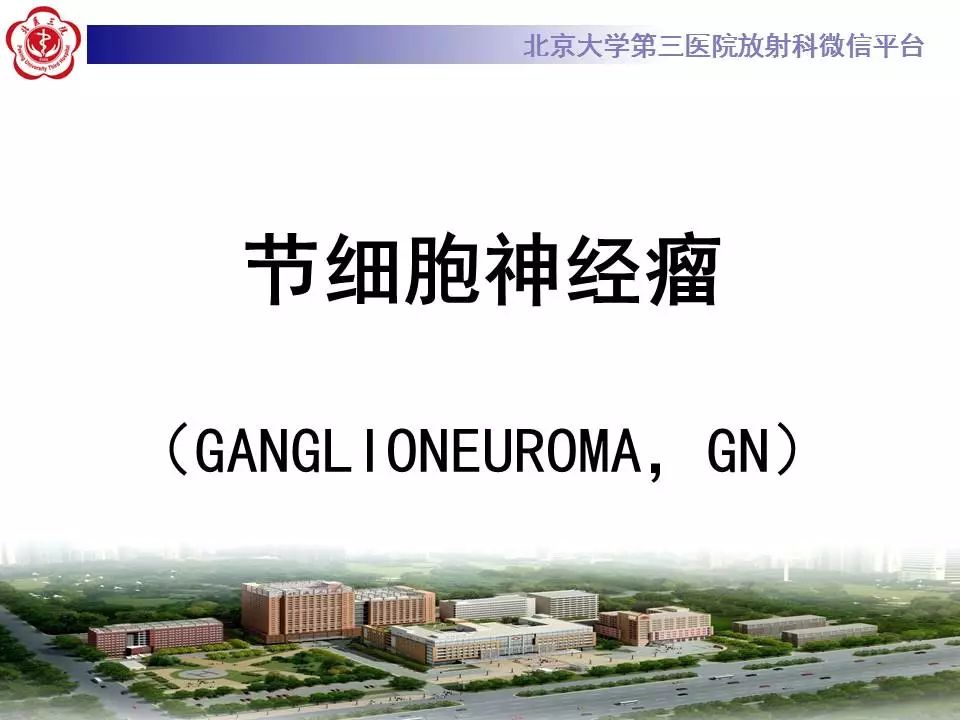 【病例】纵隔节细胞神经瘤1例CT影像表现