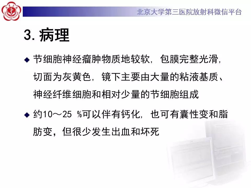 【病例】纵隔节细胞神经瘤1例CT影像表现