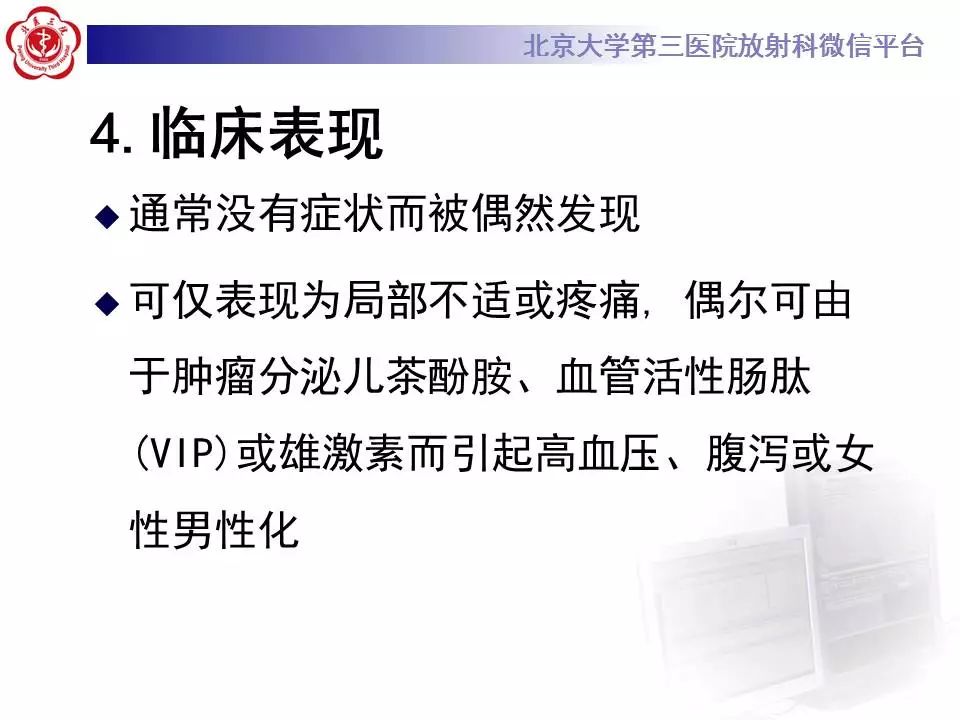 【病例】纵隔节细胞神经瘤1例CT影像表现