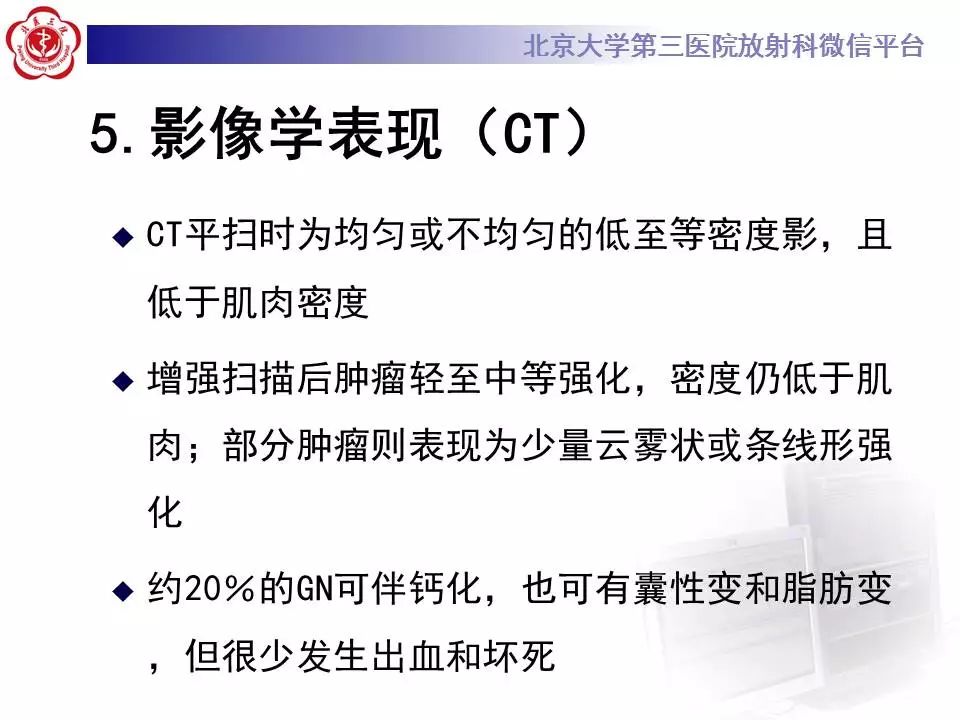 【病例】纵隔节细胞神经瘤1例CT影像表现