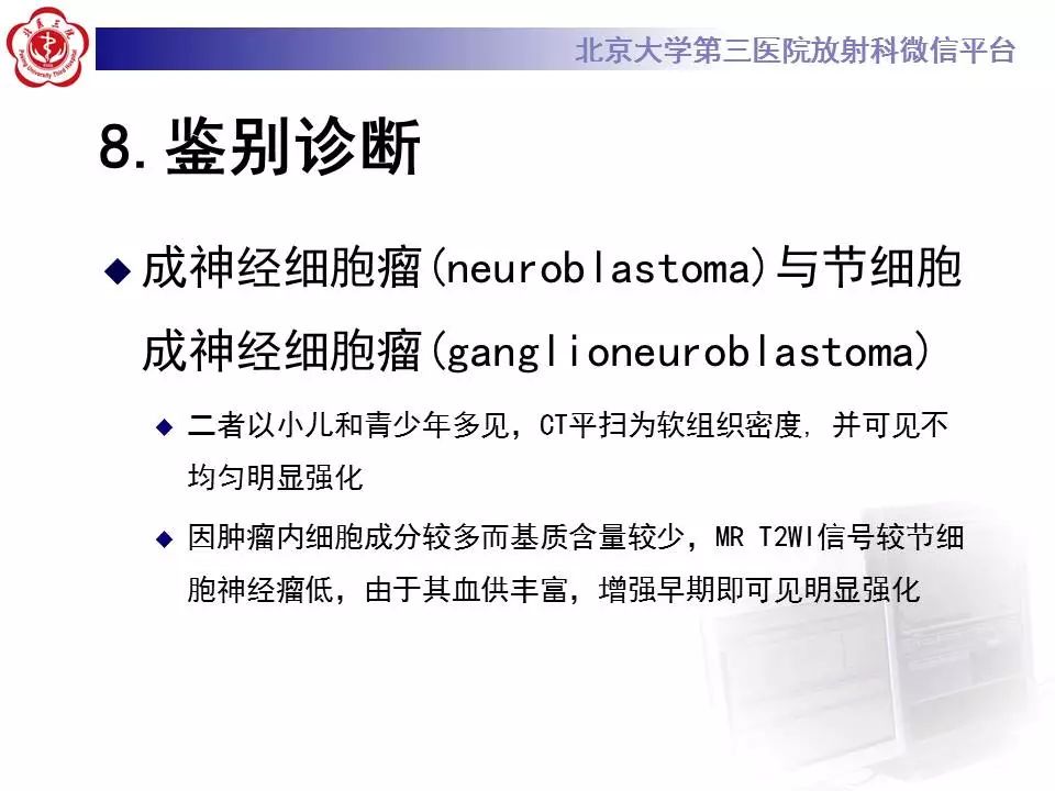 【病例】纵隔节细胞神经瘤1例CT影像表现