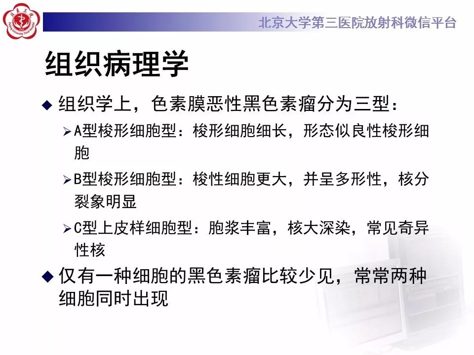 【PPT】色素膜黑色素瘤