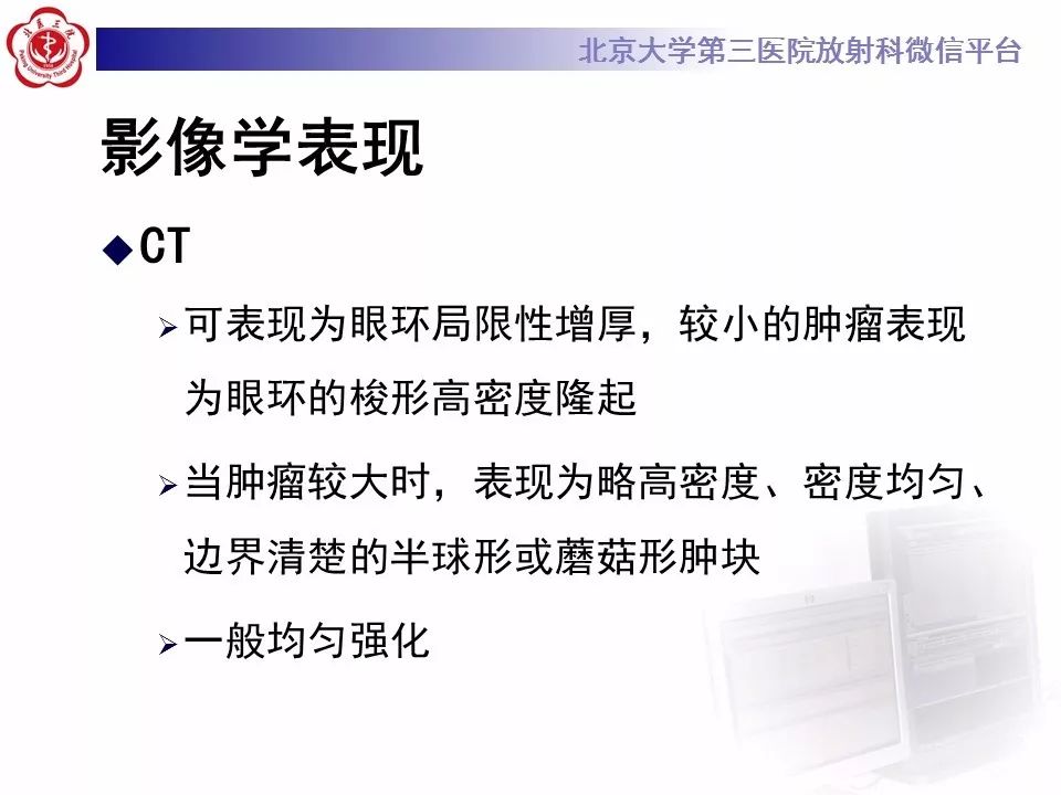 【PPT】色素膜黑色素瘤