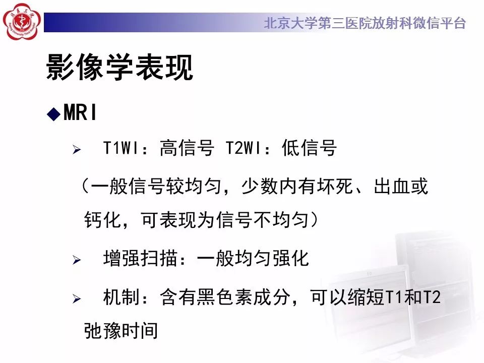 【PPT】色素膜黑色素瘤