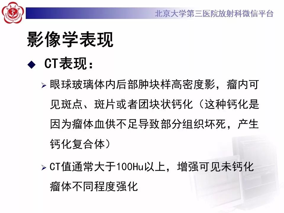 【PPT】色素膜黑色素瘤