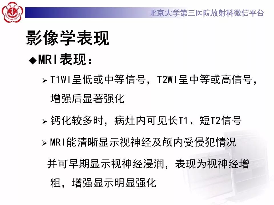 【PPT】色素膜黑色素瘤