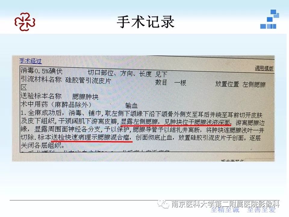 【PPT】专题读片—腮腺混合瘤的影像表现