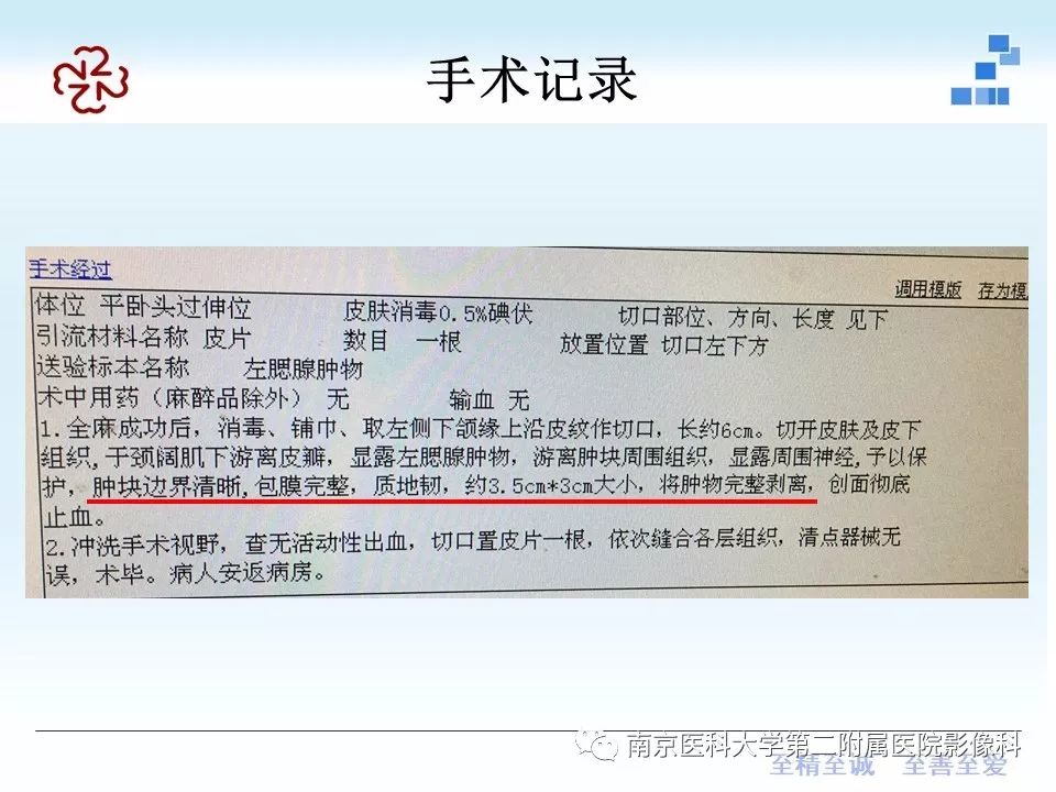 【PPT】专题读片—腮腺混合瘤的影像表现
