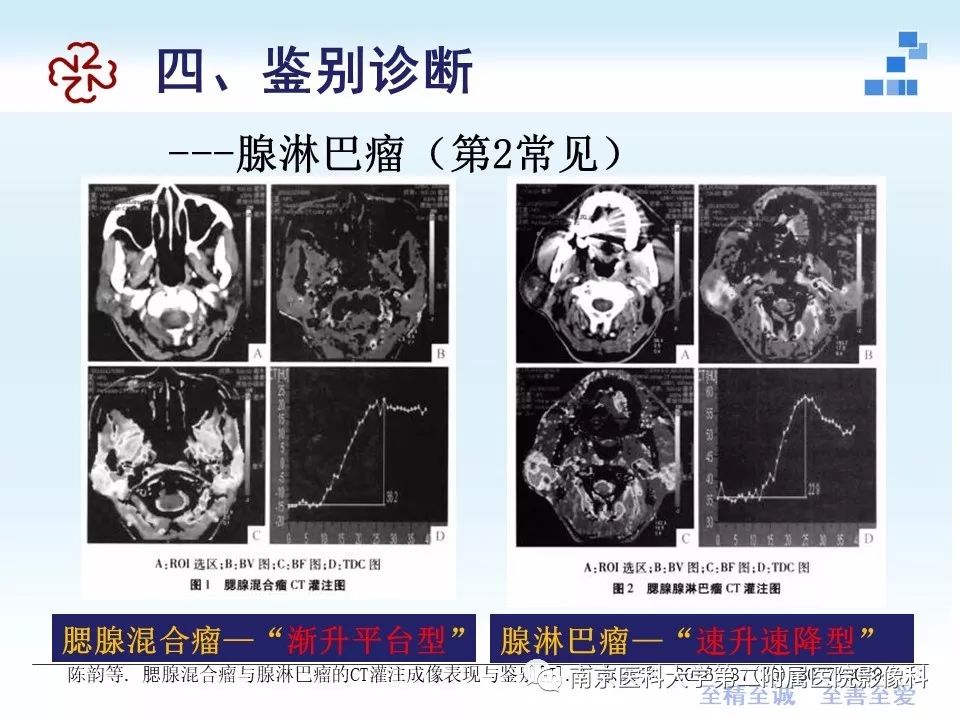 【PPT】专题读片—腮腺混合瘤的影像表现