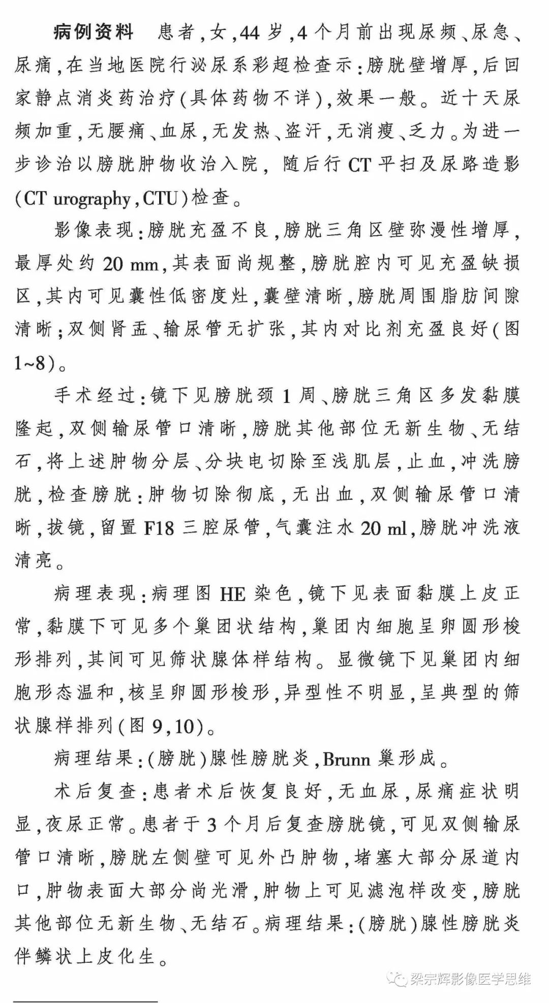 【病例】膀胱壁增厚性病变—腺性膀胱炎的诊断思维