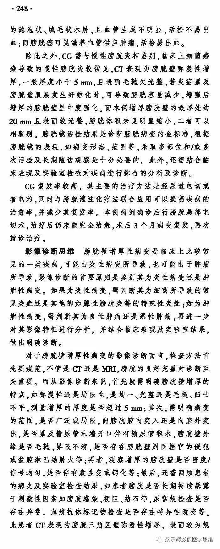 【病例】膀胱壁增厚性病变—腺性膀胱炎的诊断思维