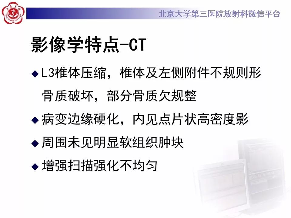 【病例】脊柱良性纤维组织细胞瘤1例CT及MR
