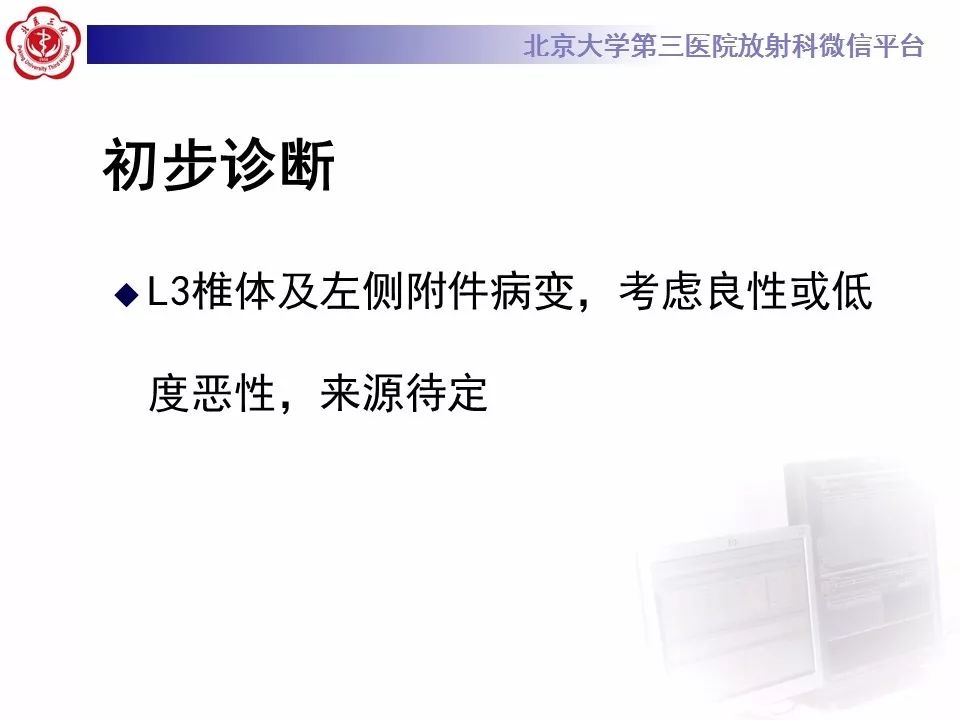 【病例】脊柱良性纤维组织细胞瘤1例CT及MR